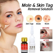 Mole removal cream